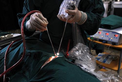 西藏完成高原首例鼻腔鼻窦颅底肿瘤切除术