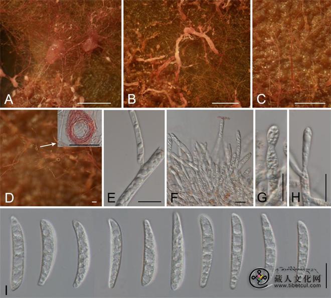 西藏珠峰地区发现两种真菌新物种1.jpg